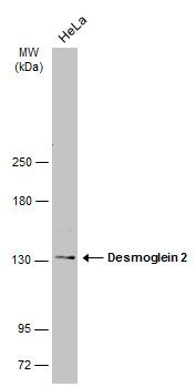 Desmoglein 2 antibody [N1N2], N-term