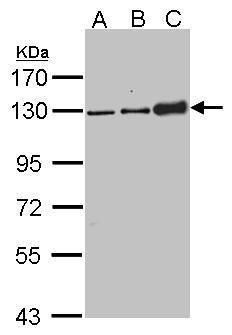 Desmoglein 2 antibody