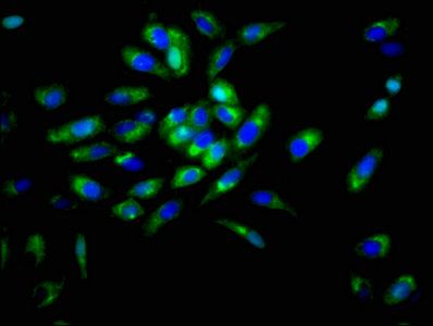 Desmoglein-3 antibody