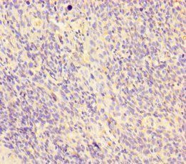 Desmoglein-3 antibody