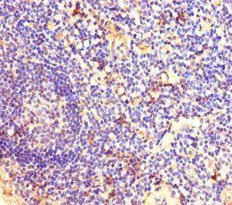 DSG3 Antibody