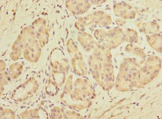 DET1 Antibody