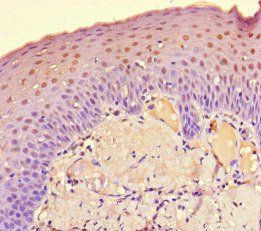 DET1 Antibody