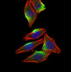 CAMK4 Antibody