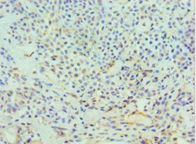 DFFA Antibody