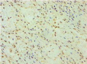 GSDME Antibody
