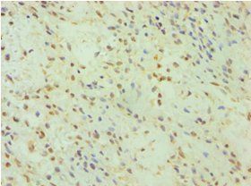 DFNA5 antibody