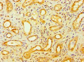 GSDME Antibody