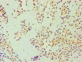 GSDME Antibody