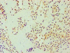 DFNA5 antibody