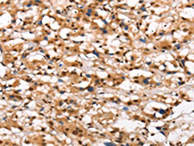 DGAT1 Antibody