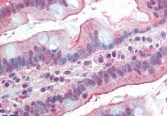 Goat anti-DGAT1 (aa67-79) Antibody