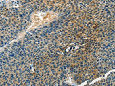 DGKB Antibody