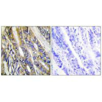 DGKH Antibody
