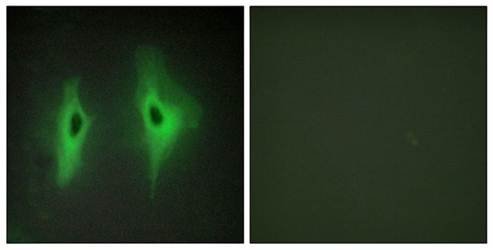 DGKH Antibody