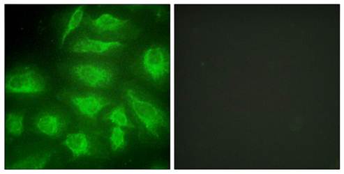DGKI Antibody