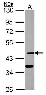 argininosuccinate lyase Antibody