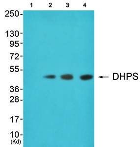 DHPS antibody