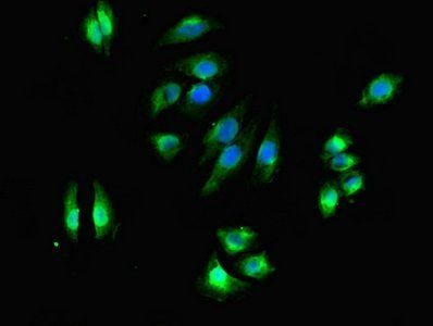 DHRS3 Antibody