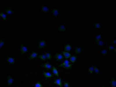 DHRS3 antibody