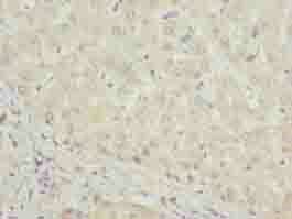 DHRS3 Antibody