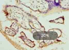 DHRS3 antibody