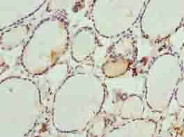 DHRS3 antibody