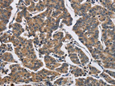 DHRS3 Antibody