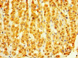 DHRS7 Antibody