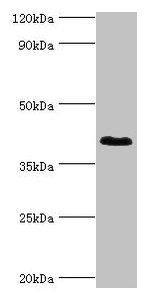 DHRS7 Antibody