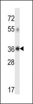 DHRS7C antibody
