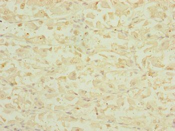DHTKD1 Antibody
