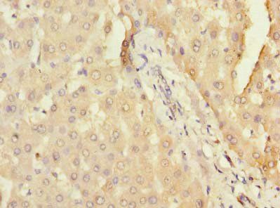 DHX30 Antibody