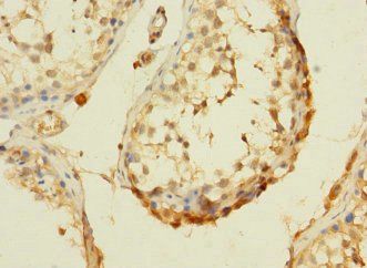 DHX32 Antibody