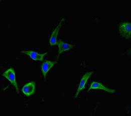 DHX33 antibody