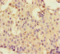 DHX33 Antibody