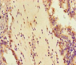 DHX33 Antibody