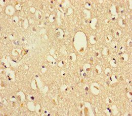 DHX35 Antibody