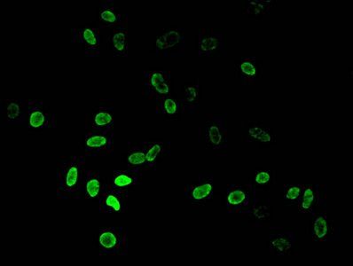 Di-methyl-HIST1H3A (K36) Antibody