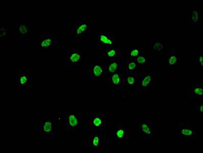 Di-methyl-HIST1H3A (K36) Antibody