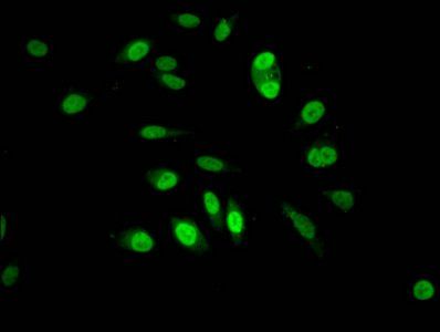 Di-methyl-HIST1H3A (K4) antibody