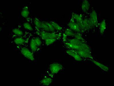 Di-methyl-HIST1H3A (K4) Antibody