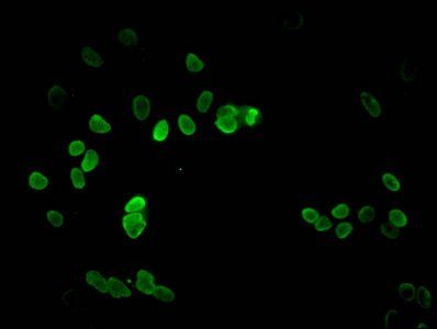 Di-methyl-HIST1H3A (K9) Antibody