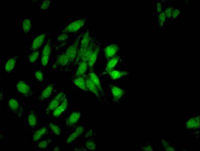 Di-methyl-HIST1H3A (K9) Antibody
