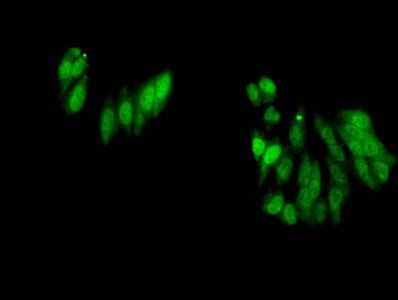 Di-methyl-HIST1H3A (R17) Antibody