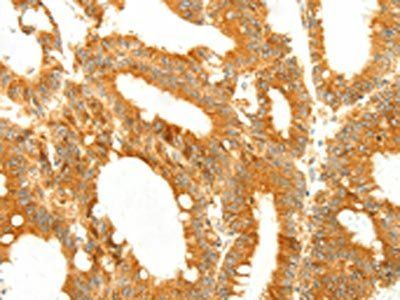 DIABLO Antibody