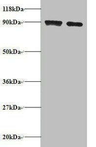 Diamine acetyltransferase 1 antibody