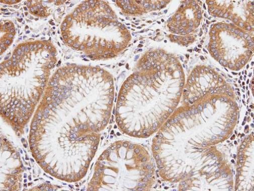 DIAPH1 antibody [N1N2], N-term