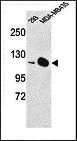 DIAPH2 antibody