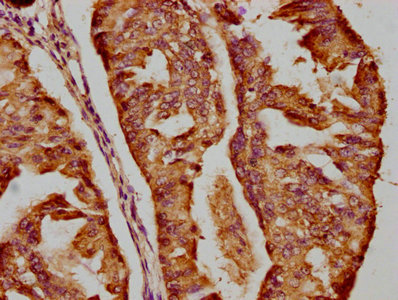 DICER1 Antibody